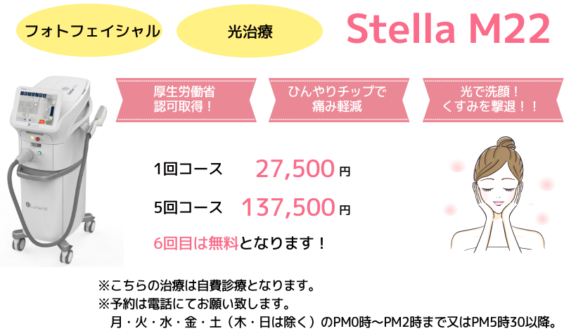 Stella M22（ステラM22）